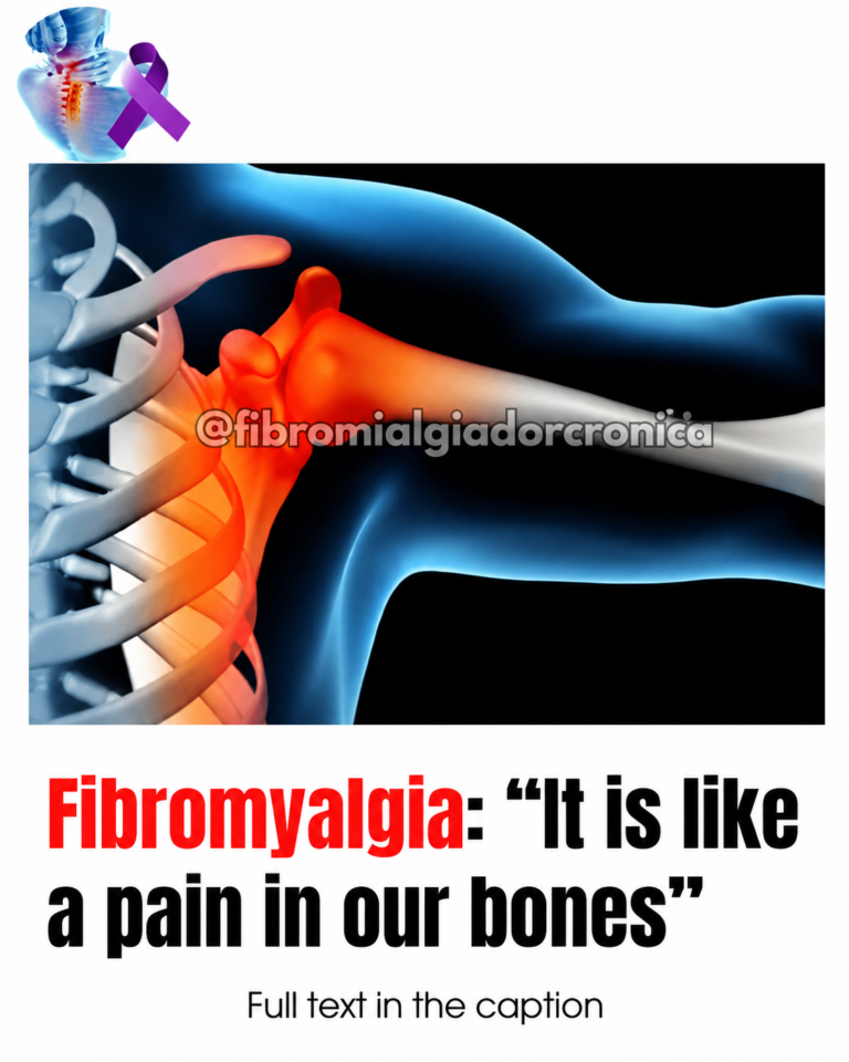 Can fibromyalgia cause bone pain without joint involvement?